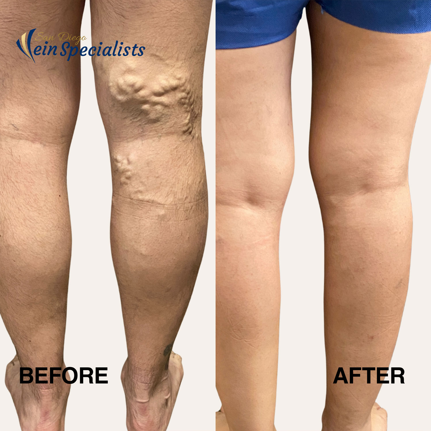 San Diego Vein Specialists 1