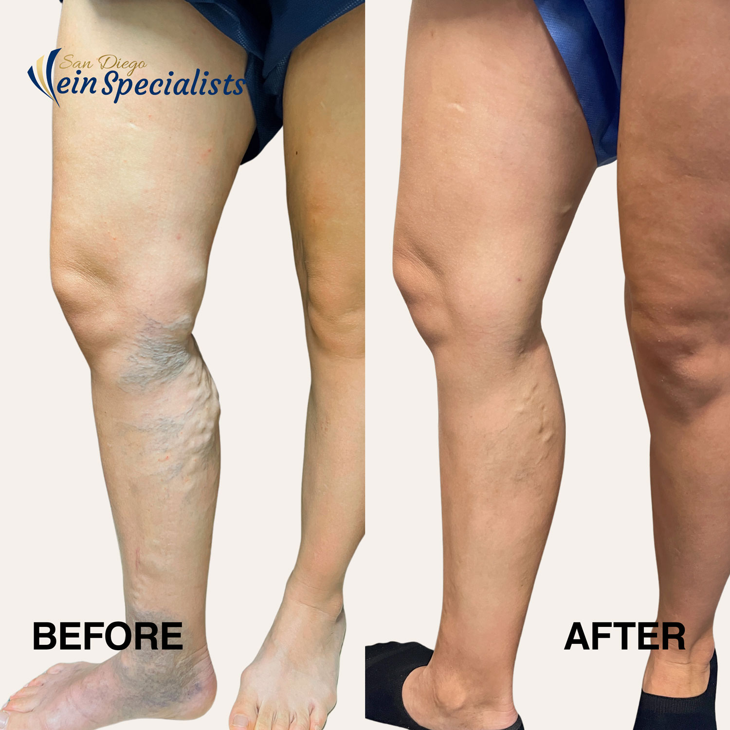 San Diego Vein Specialists