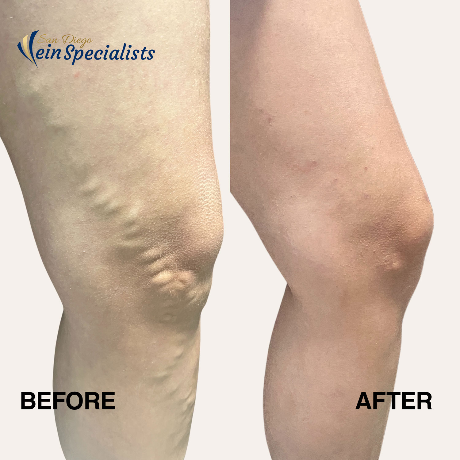 San Diego Vein Specialists 6